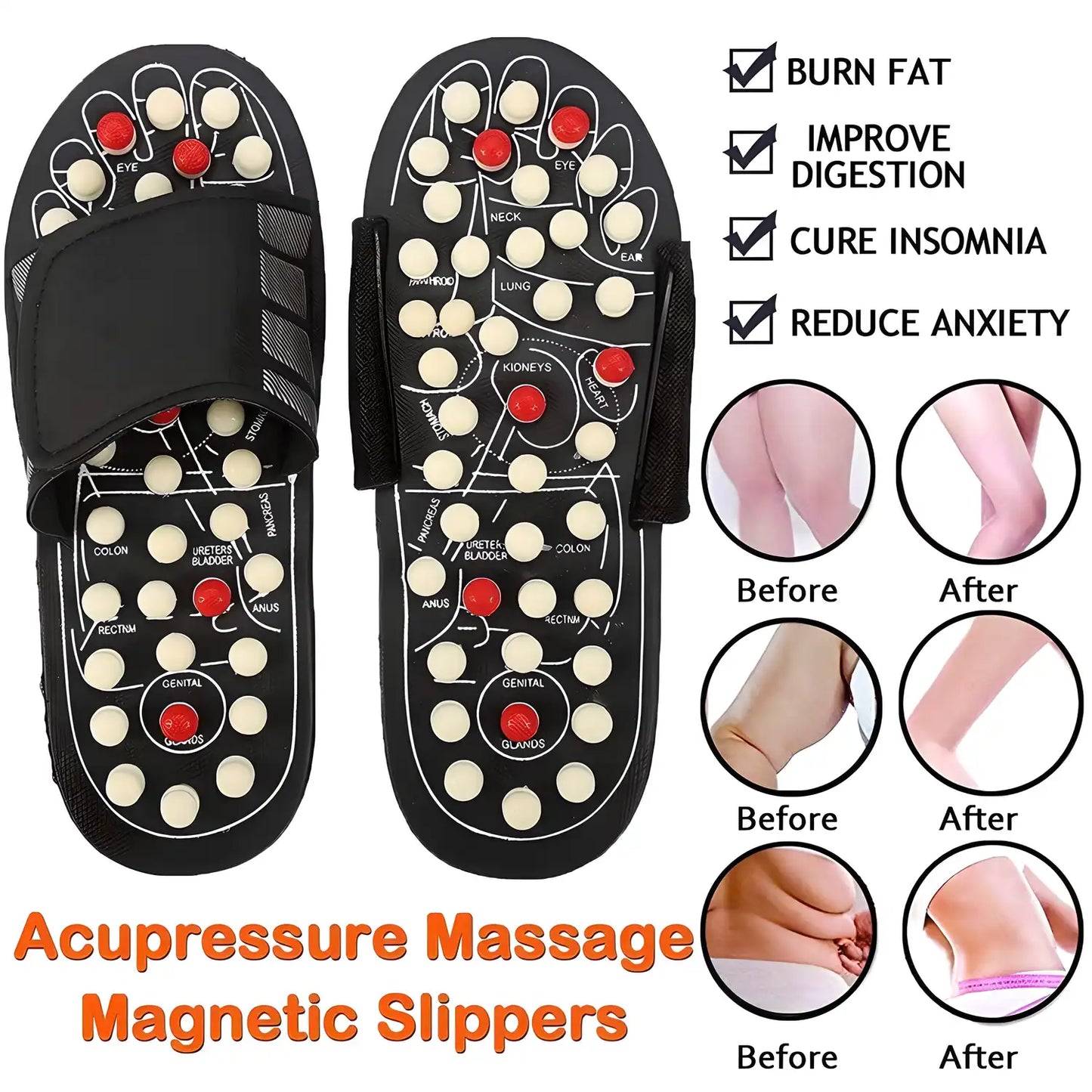 Acupressure Foot Relaxer Massager Slipper - CL-SU-786